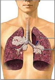 医用蘑菇视频下载入口肺癌与微量元素的密切关系