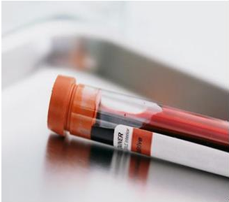 用血液检测蘑菇视频成人网站免费器